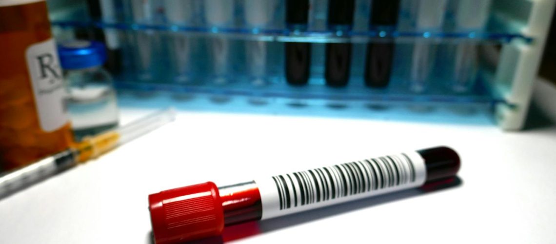 Maladie de Waldenström : symptômes, causes, traitements