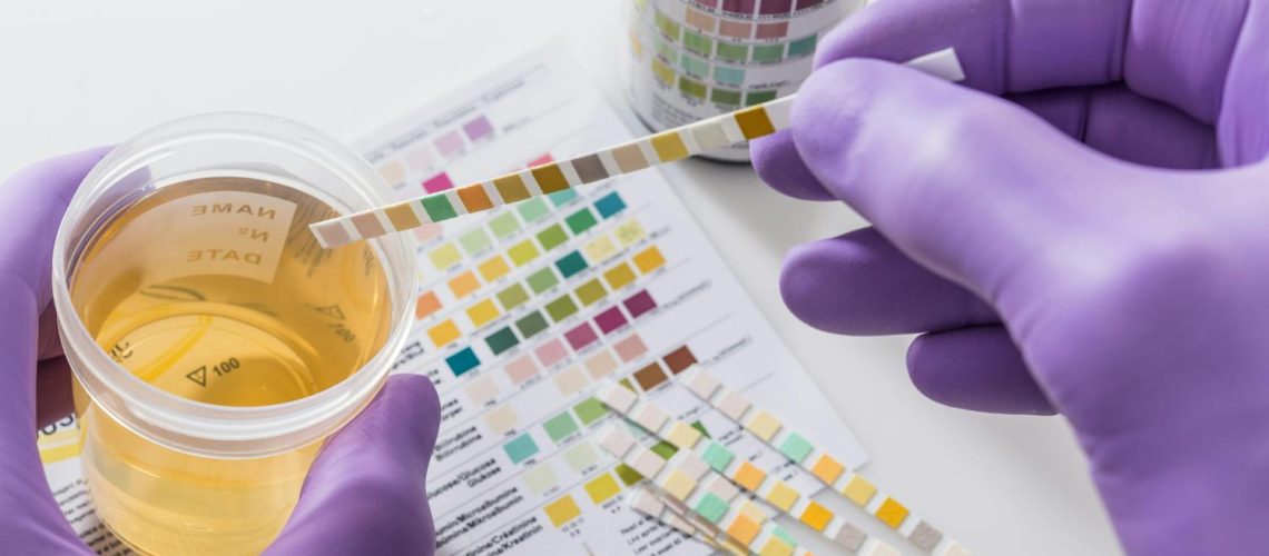 Du sang dans les urines : faut-il s'inquiéter ?